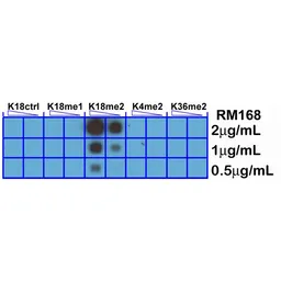 Anti-Histone H3K18me2 (Di-methyl Lys18) antibody [RM168] used in Dot blot (Dot). GTX60899